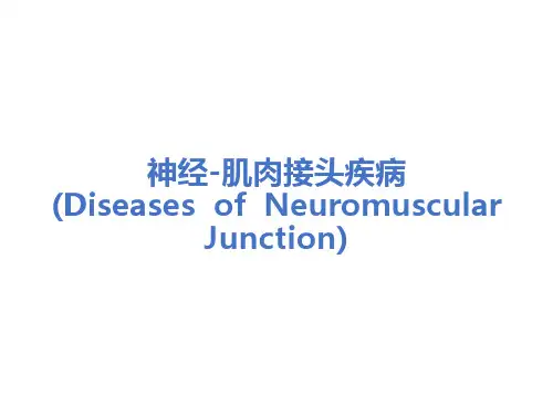神经肌肉接头疾病-重症肌无力
