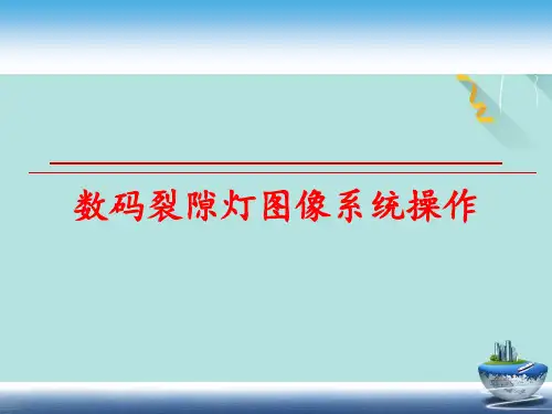 数码裂隙灯图像系统操作PPT优选版