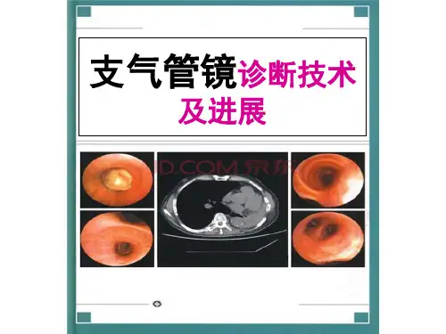 支气管镜诊断技术及进展
