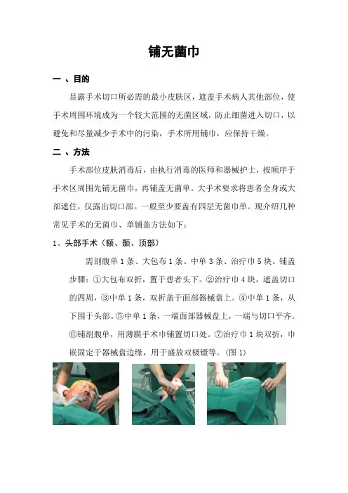 铺无菌巾