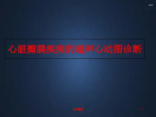 心脏瓣膜疾病的超声心动图诊断  ppt课件