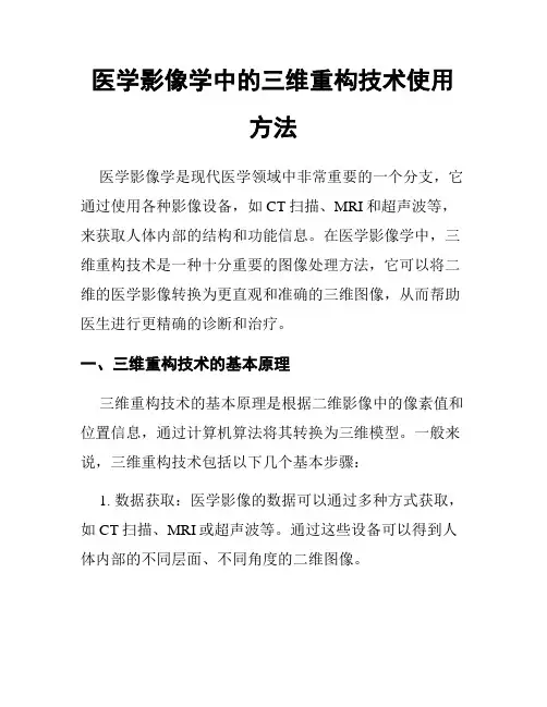 医学影像学中的三维重构技术使用方法