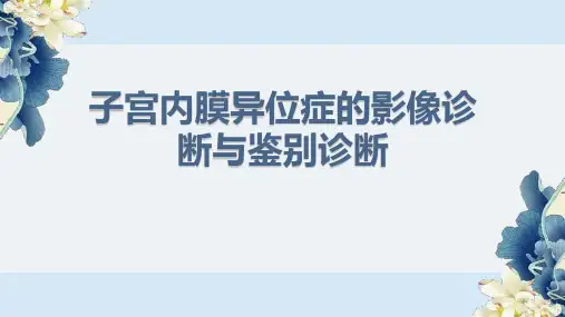 子宫内膜异位症的影像诊断与鉴别诊断