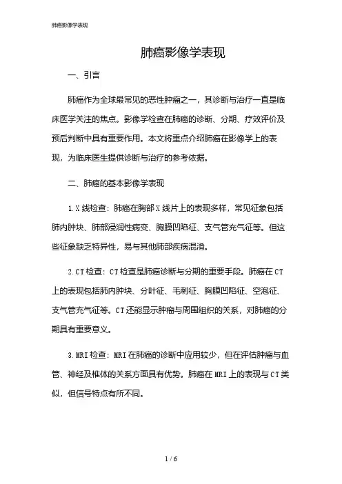 2024年肺癌影像学表现