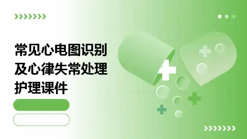 常见心电图识别及心律失常处理护理课件