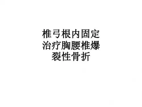 椎弓根内固定治疗胸腰椎爆裂性骨折ppt课件