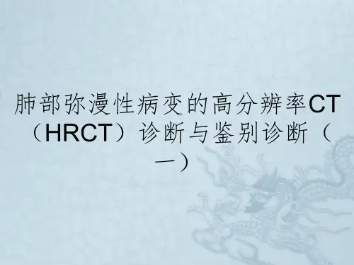 肺部弥漫性病变的高分辨率CT(HRCT)诊断与鉴别诊断(一)