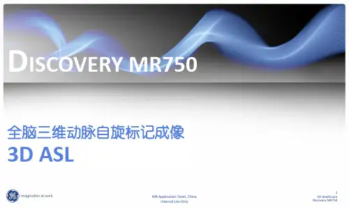 头部ASL灌注成像