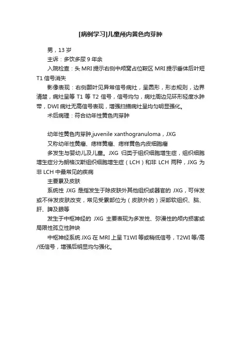 [病例学习]儿童颅内黄色肉芽肿