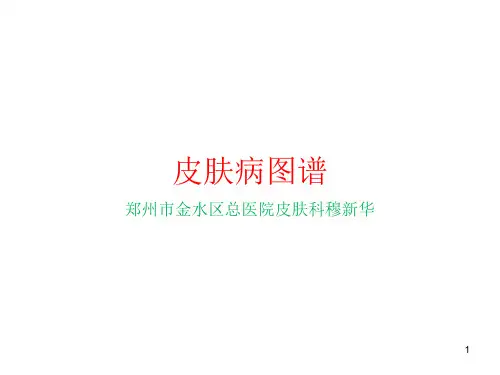 皮肤病图谱PPT参考幻灯片