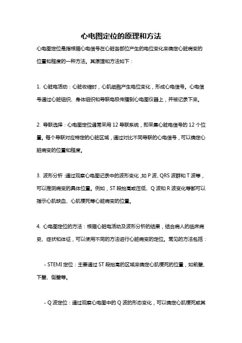 心电图定位的原理和方法