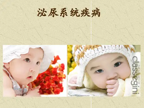 儿科学课件泌尿系统