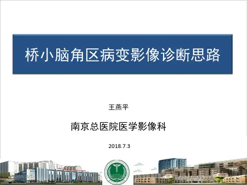 桥小脑角病变的影像诊断思路+PPT课件