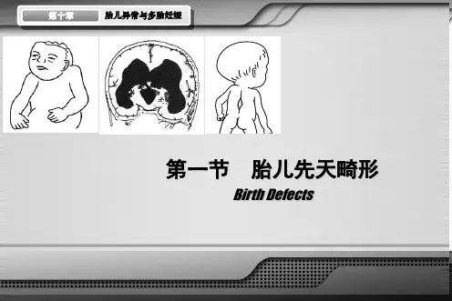 胎儿异常与多胎妊娠1