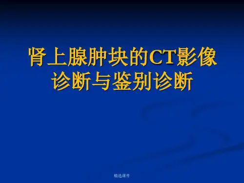 肾上腺肿块的CT影像诊断与鉴别