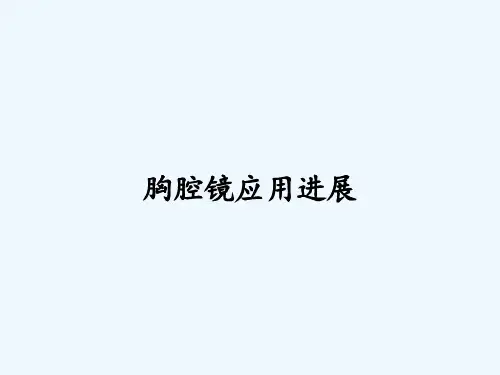 胸腔镜应用进展 PPT