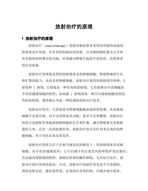 放射治疗的原理