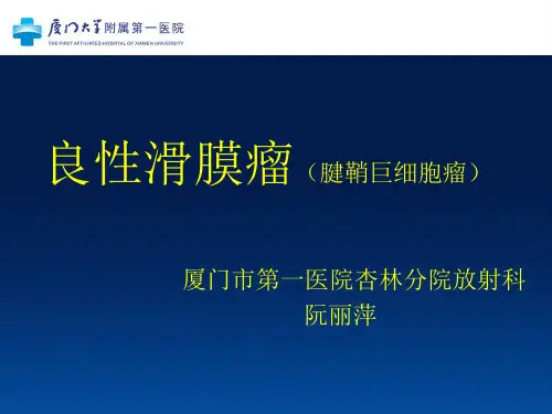 良性滑膜瘤(腱鞘巨细胞瘤)