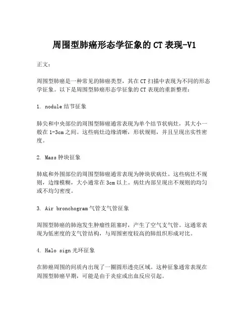 周围型肺癌形态学征象的CT表现-V1