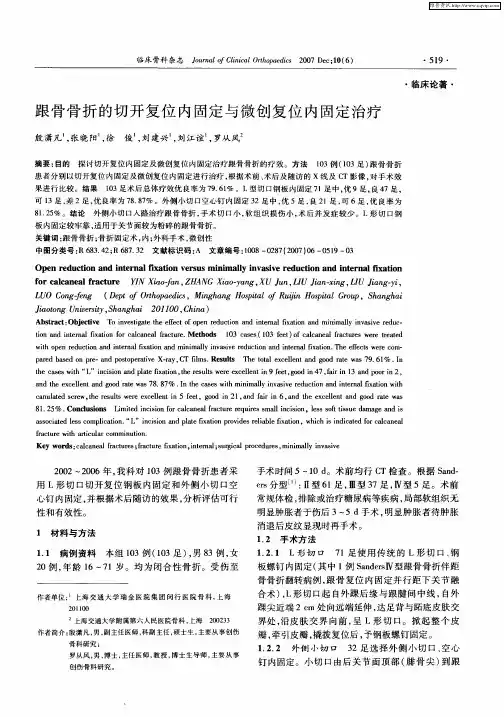 跟骨骨折的切开复位内固定与微创复位内固定治疗