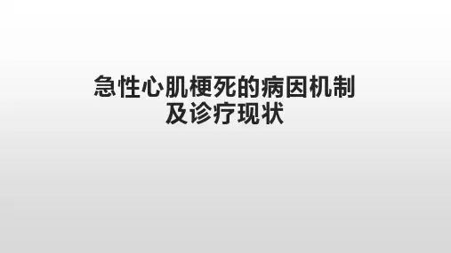 急性心肌梗死的病因机制及诊疗现状
