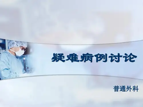 布-加综合征1