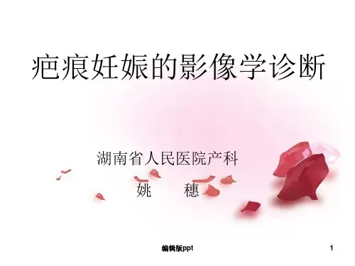 疤痕妊娠的影像学诊断