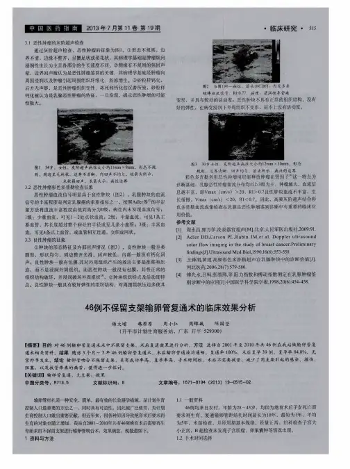 46例不保留支架输卵管复通术的临床效果分析