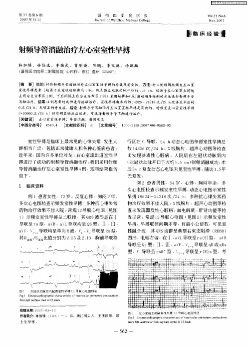 射频导管消融治疗左心室室性早搏