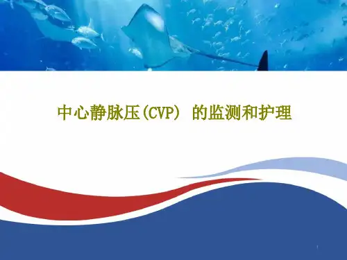 中心静脉压(CVP)的监测和护理课件