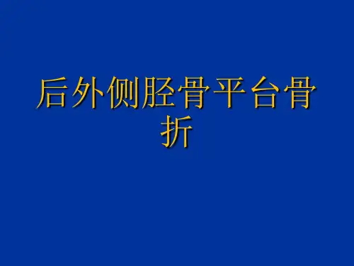 后外侧胫骨平台骨折ppt课件