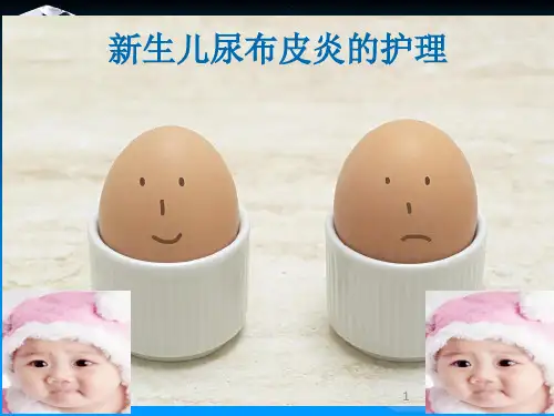新生儿尿布皮炎的护理PPT课件