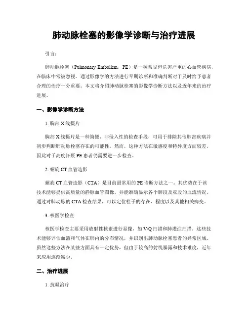肺动脉栓塞的影像学诊断与治疗进展