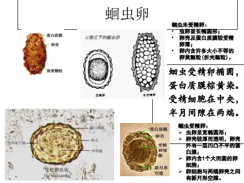 寄生虫学虫卵经典总结及图片 yj 