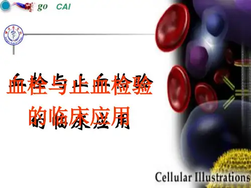 血友病-精品医学课件