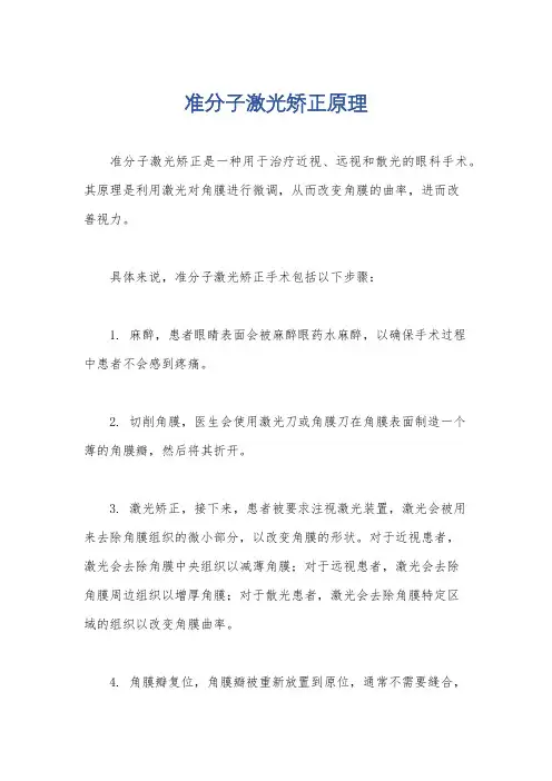 准分子激光矫正原理