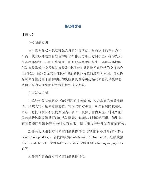 晶状体异位