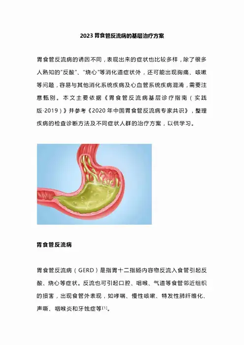 2023胃食管反流病的基层治疗方案