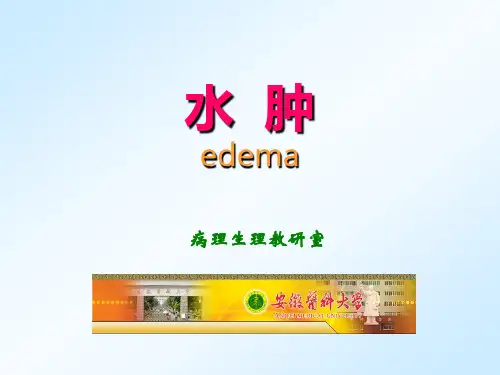 病理生理学课件-水肿