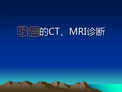 喉癌的CTMRI诊断