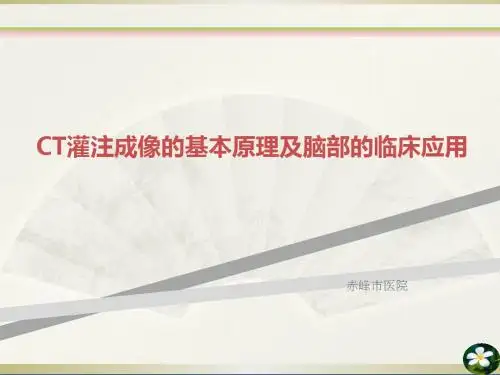 CT灌注成像的基本原理及脑部的临床应用
