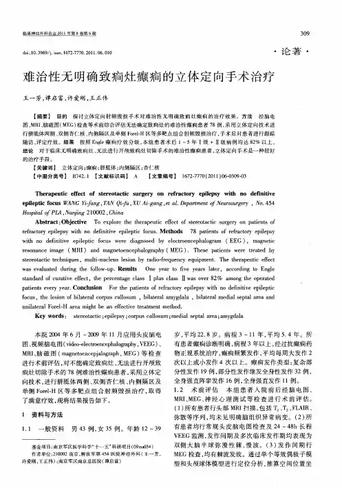 难治性无明确致痫灶癫痫的立体定向手术治疗