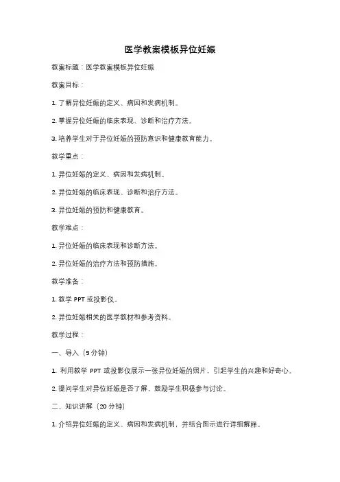 医学教案模板异位妊娠