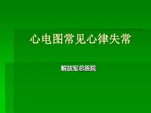 心电图常见心律失常