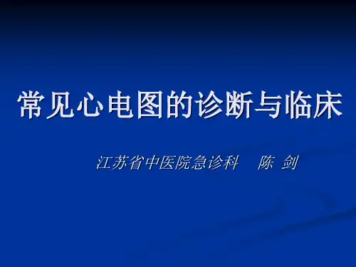经典：常见心电图诊断与临床