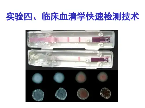 (动物传染病学实验课件)5 临床血清学快速检测技术