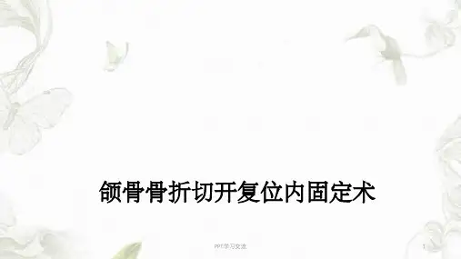 上下颌骨骨折课件