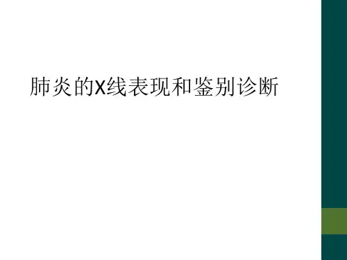 肺炎的X线表现和鉴别诊断