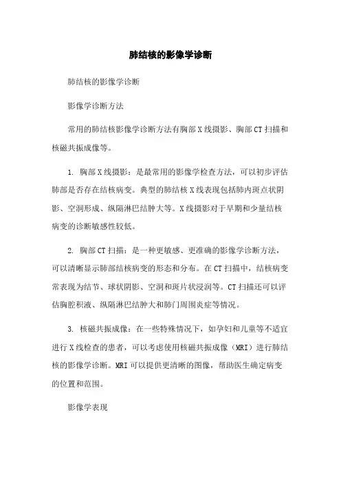 肺结核的影像学诊断