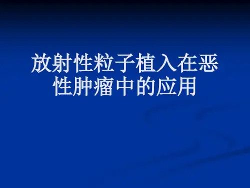 放射性粒子植入在恶性肿瘤中应用